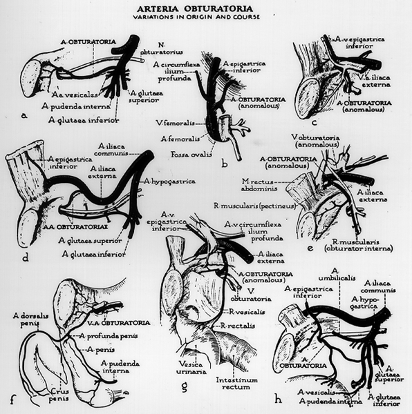 Image of obturator artery