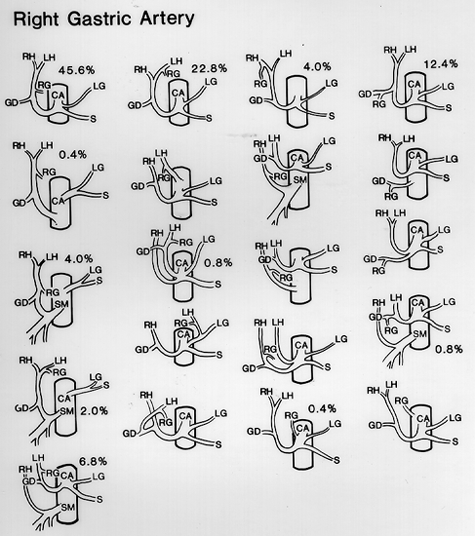 image of variations in origin of right gastric artery