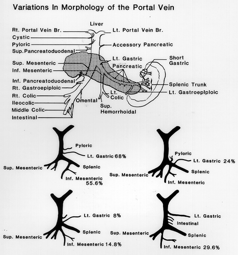 Image of portal vein and its origin upper