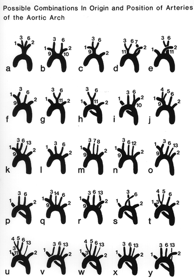 Image of arteries of aortic arch