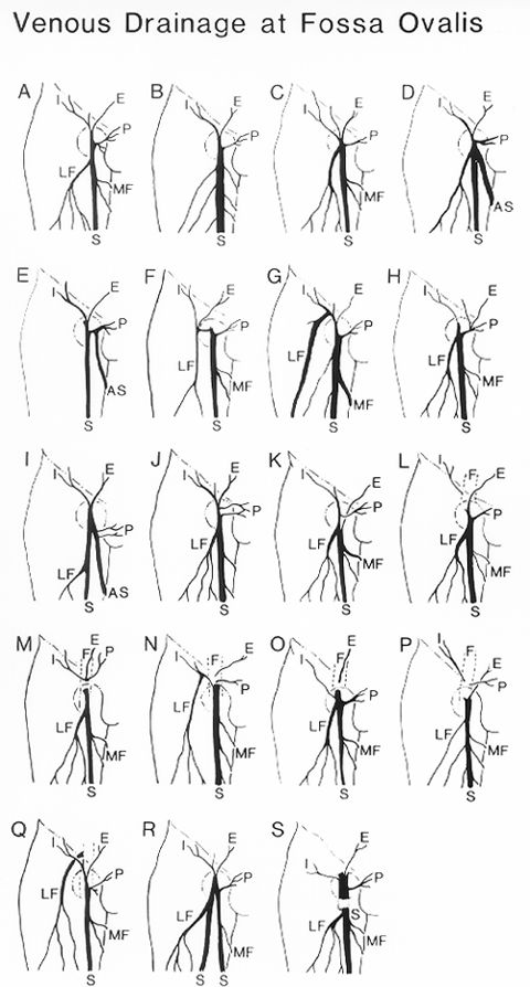 Image of venous drainage at the fossa ovalis