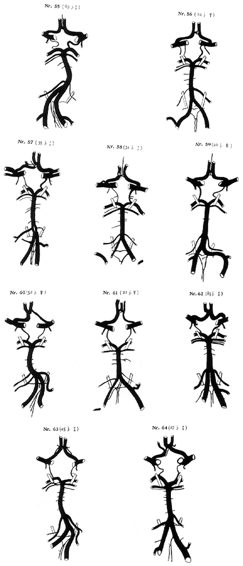 Image of variations in circle of Willis