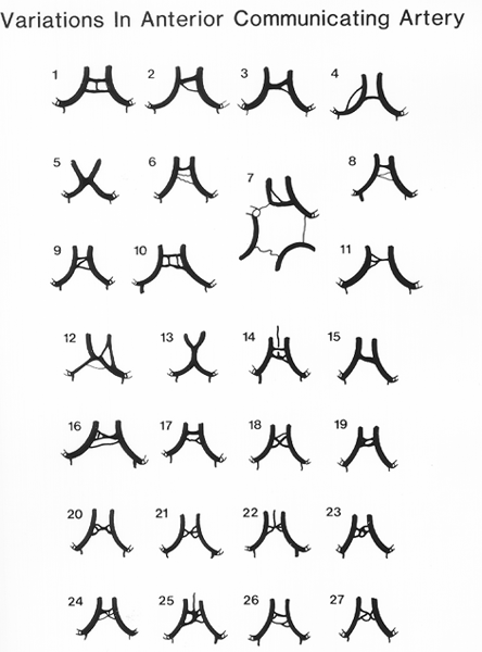 Image of variations in anterior communicating artery