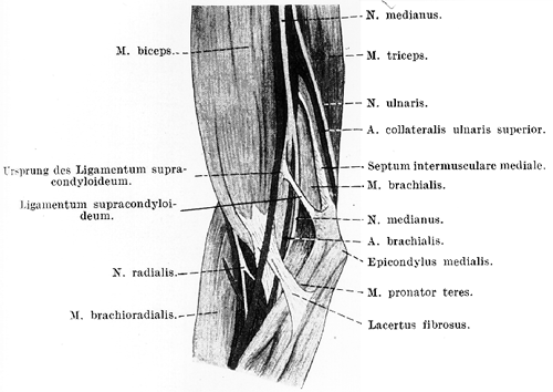 Image of brachial artery beneath ligament of struthers