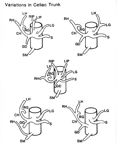 Image of variations in the celiac trunk