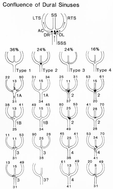 Image of confluens of sinuses