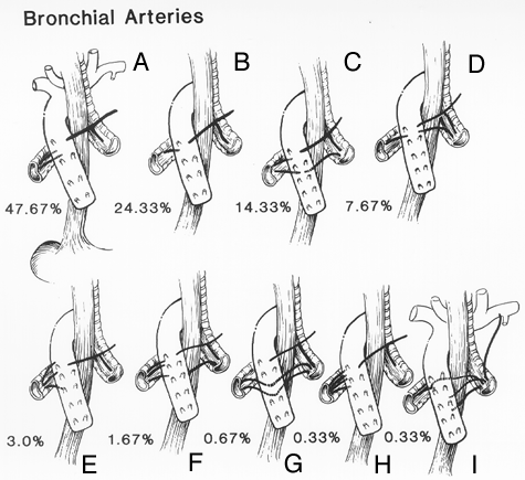 Image of bronchial arteries