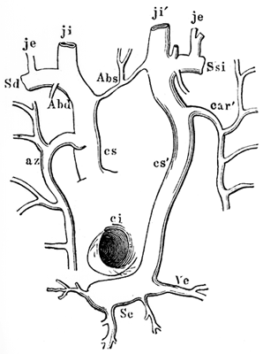 Image of doubled superior vena cava