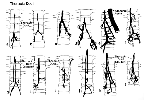 Image of variations in form of thoracic duct