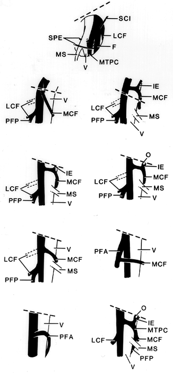 Image of femoral artery and branches