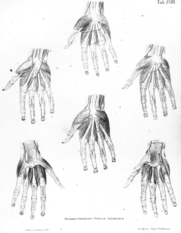 Image of variations in palmar arteries, radial and ulnar