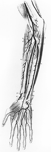 Image of the superficial median artery supplying superficial plamar arch