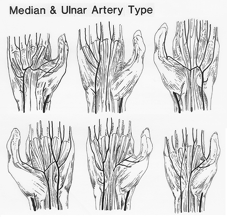 Image of superficial palmar arch