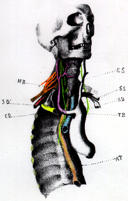 Image of retroesophageal right subclavian artery and absence of recurrent laryngeal nerve