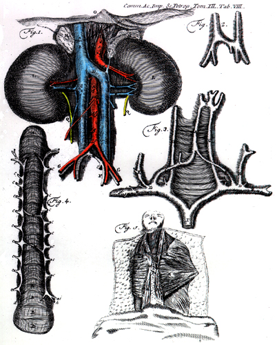 Image of doubled inferior vena cava