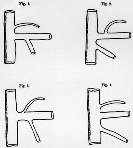 Image of portal vein formation