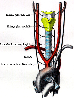 Image of absence of right recurrent laryngeal nerve retroesophageal right subclavian artery