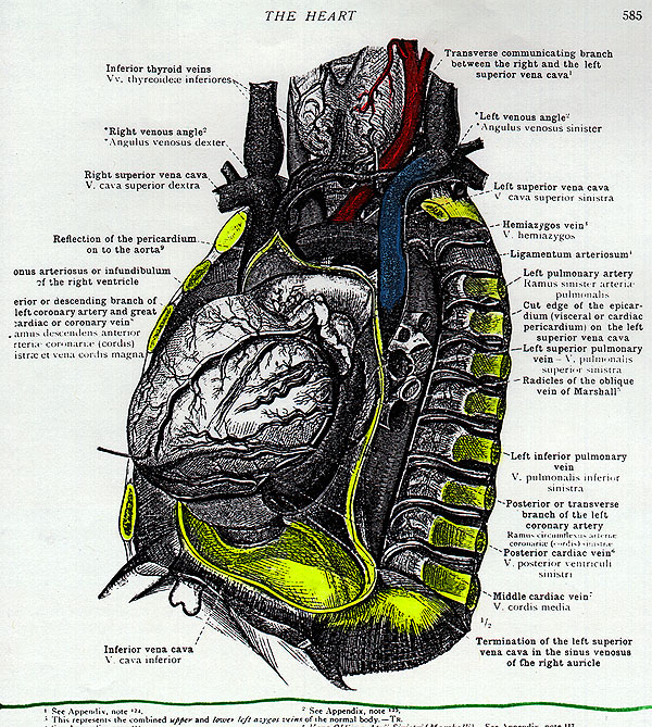 Image of left superior vena cava