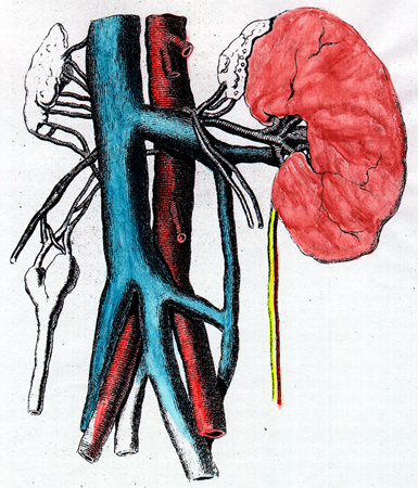 Image of left inferior cava doubled