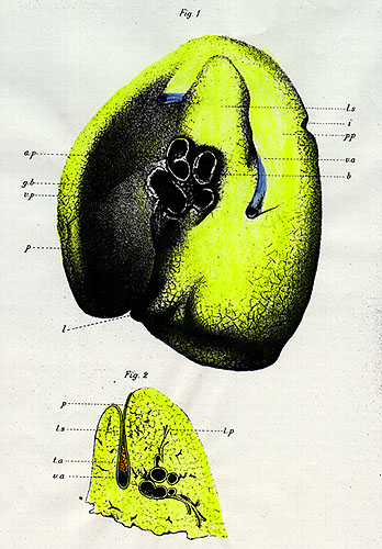 Image of azygos vein-azygos lobe of right lung