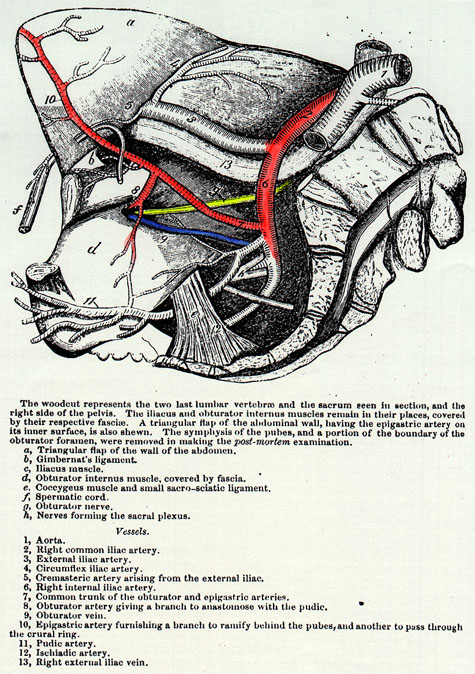 Image of common trunk for obturator and epigastric arteries