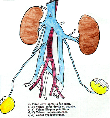 Image of left inferior vena cava