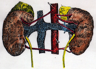 Image of multiple renal arteries, left kidney