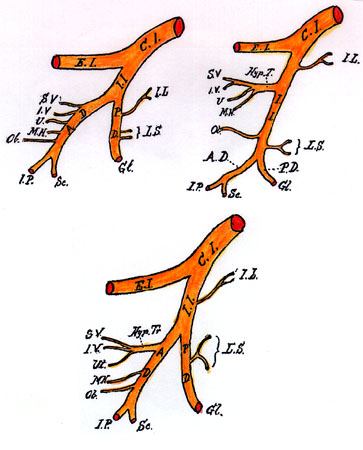 Image of origin of the variable branches of internal iliac artery