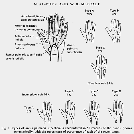 Image of superficial palmar arteries using doppler ultrasonic flowmeter