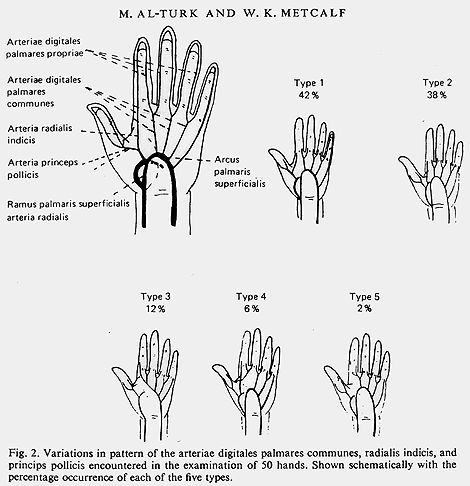 Image of superficial palmar arteries