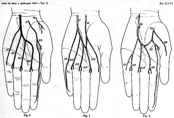 Image of some variations in deep palmar arch