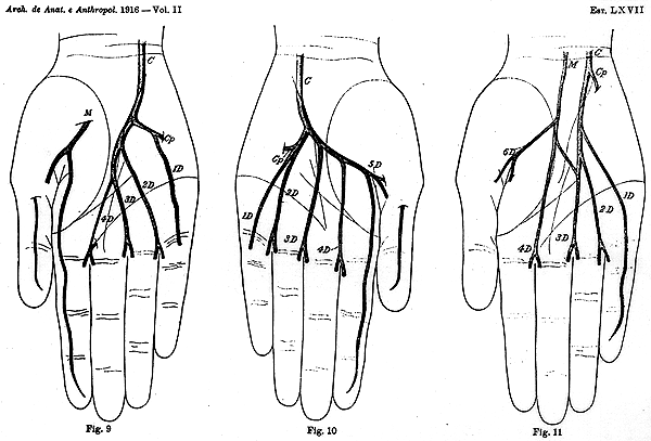 Image of some variations in deep palmar arch