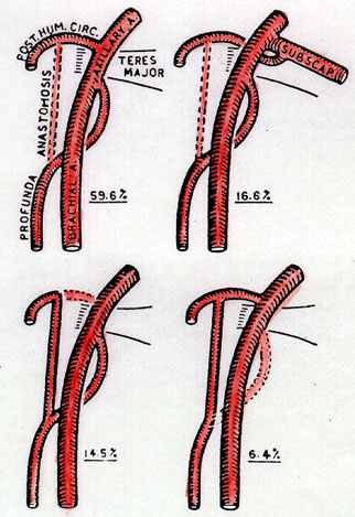 Image of variations in origin