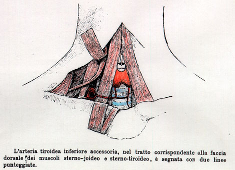 Image of accessory inferior thyroid artery