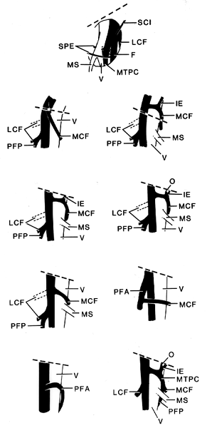 Image of femoral artery and its branches