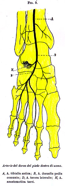 Image of dorsalis pedis artery variations