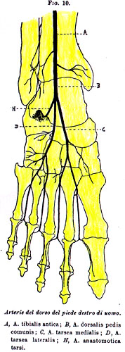 Image of dorsalis pedis artery variations