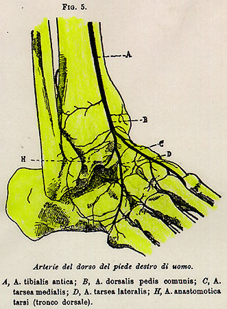 Image of dorsalis pedis artery variations