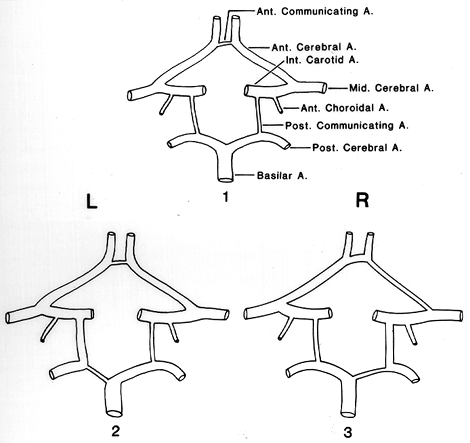 Circle of Willis, usual and unusual