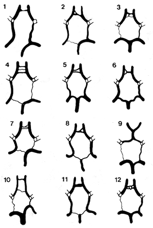 Image of variable circle of Willis