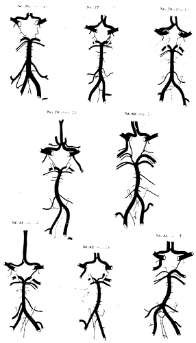 Image of variations in circle of Willis