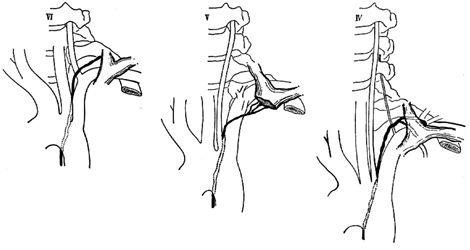 Image of vertebral artery and thoracic duct