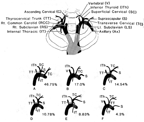 Image of thyrocervical artery