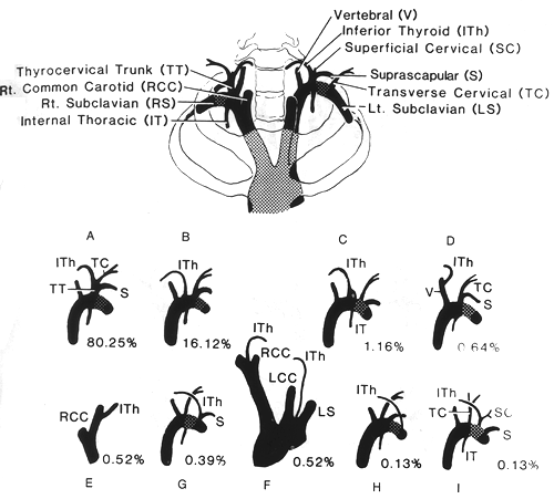 Image of inferior thyroid trunk