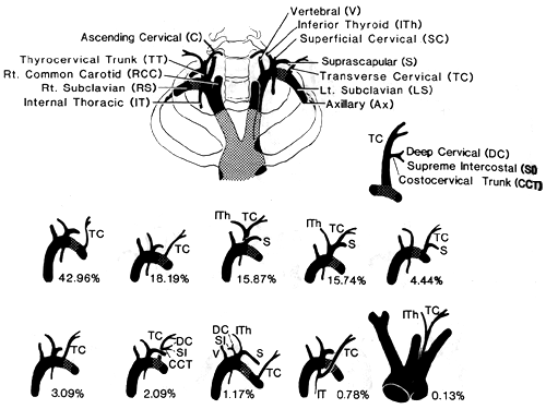 Image of transverse cervical artery