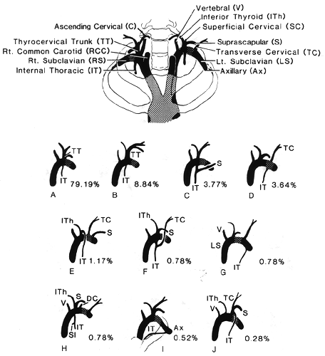 Image of internal thoracic artery