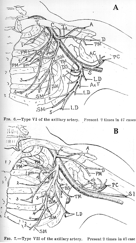 Image of composite study of axillary artery