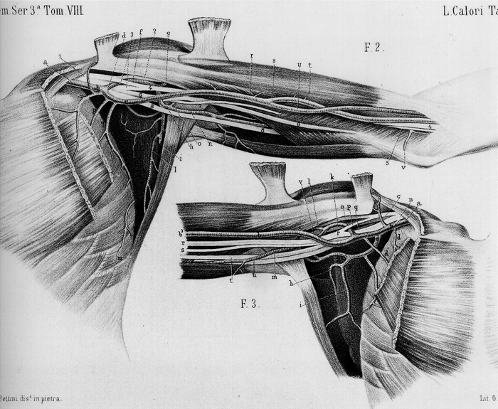 Image of anomalous axillary artery