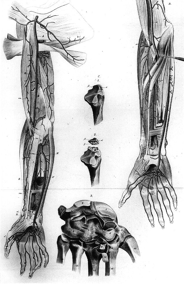 Image of radial artery with three roots