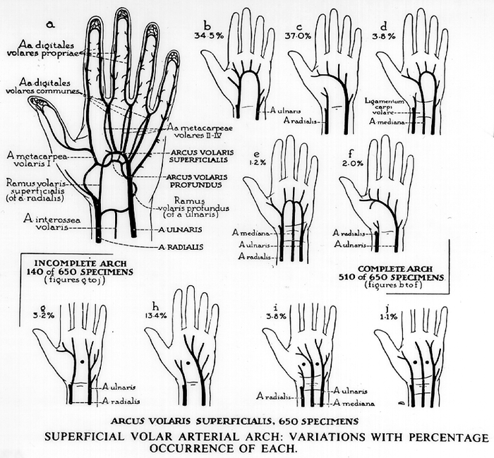 Image of superficial palmar arch